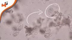 هذه التقنية عبارة عن خلايا صغيرة جداً تدعى أثروبوتس ويمكن برمجتها للقيام بعمليات طبية داخل الجسم.