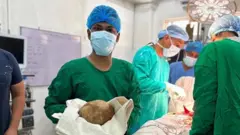 Umuganga abaga yambaye impuzu z’akazi z’ibara ry’icatsi kibisi n’agafukamunwa, afise mu minwe ibuye rinini ryakuwe mu gasaho k’umukoyo k’umurwayi.