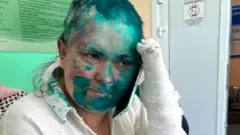 Yelena Milashina dan pengacara Alexander Nomov dibawa ke rumah sakit.