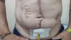 напис