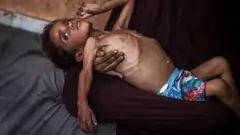 Yezen, un niño de dos años, en el regazo de su madre
