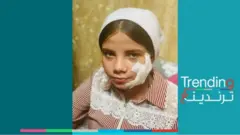 فاطمة طالبة مصرية تدفع ثمن رفضها مساعدة زميلتها على الغش بـ 140 غُرزة