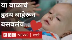बाळाचं हृदय असं सुरू राहिलं