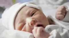 Bebé con lesiones por fórceps.