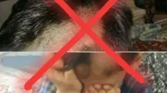 ویښتان