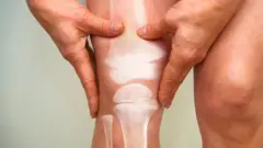 కీళ్ల వాపు