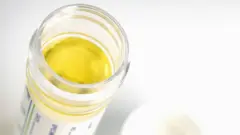 پیشاب، امریہ