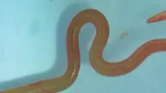 Ako kayoka bamukuye m'ubwonko kareha na 8cm