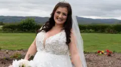 மெலிசா ஆஷ்கிராஃப்ட், ஸ்காட்லாந்து, மார்பக குறைப்பு அறுவை சிகிச்சை