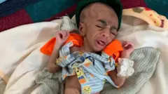 በምስራቅ ትግራይ በረሃብ ተጠቅቶ ሆስፒታል የገባ ህጻን 