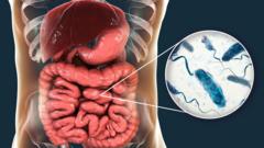 Quelles sont les causes du choléra et comment pouvez-vous vous protéger ?