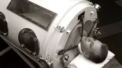 आइरन लङमा पोल एलेक्ज्यान्डर