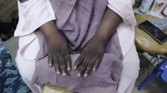 يدان سمراوين