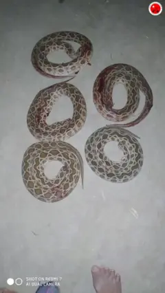 ကန့်ဘလူ၊ စစ်ဘေးရှောင်၊ မြွေကိုက်ခံရ