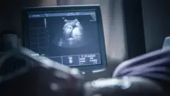 மாதிரி படம்
