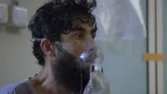 در تصویر صورت عبدالمجید مرد ۳۰ ساله در حالی که ماسک اکسیژن به صورتش زده دیده می‌شود. او با ریش و موی بلند به سمت راست تصویر نگاه می‌کند.