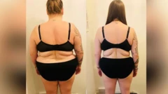 before and after