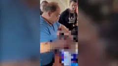 طبيب فلسطيني يبتر قدم ابنة أخيه في المنزل في غزة دون مخدر