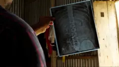 মেরুদণ্ডে বুলেট নিয়ে বেড়াচ্ছেন শাকিল