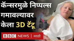 ब्रेस्ट कॅन्सर