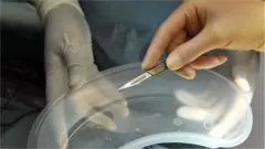 Scalpel and kidney dish (generic posed image)