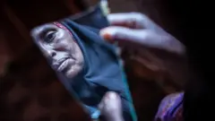 Amran Mahamood Somali'de geçimini kız çocuklarını sünnet ederek sağlıyor