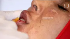 SA