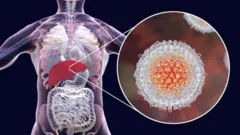 ilustracija Hepatitisa C