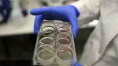 চিকিৎসার একটি পদ্ধতি স্টেম সেল থেরাপি, ফাইল ছবি