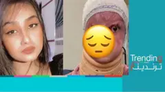 غضب في العراق بعد تشويه شاب جسم فتاة بحمض الكبريتيك