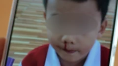 วิกฤตฝุ่นควันในเชียงใหม่ กระทบเด็กเล็กมากแค่ไหน