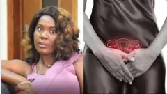  Vaginismus