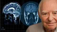 Idoso olhando para a câmera com imagem de um cérebro atrás