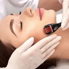 Rolo facial de microagulhamento