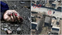 Зображення руки загиблої жінки на одному з перехресть Бучі є міжнародним символом військових злочинів росіян при наступі на Київ у березні 2022 року