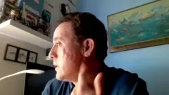 Mauricio Hoyos mostra a cicatriz deixada no rosto pelo ataque de um tubarão-das-galápagos