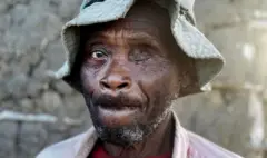 Kenya elderly man Tambala Jefwa wey suffer attack