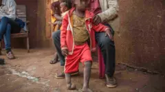 የ6 ዓመቱ ታዳጊ ከለገ ደንቢ ማዕድን ማውጫ አቅራቢያ ሲወለድ የቀኝ እርግ መዳፉ እና የግራ እግሩ ሦስት ጣቶቹ አጥንት የላቸውም።