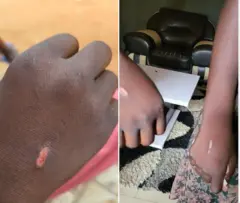 Azụ aka ụmụaka a sị e nyere akara arụ agwọ'