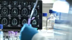 Doctor extracting liquid from a test tube in front of brain scans.
