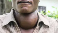 Irine Akinyi