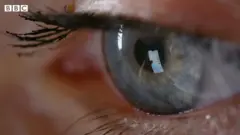 కంటి రక్షణ