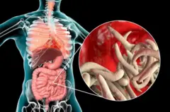 બાળકના આંતરડાંમાં કૃમિ થાય તો શું કરવું અને એનાથી બચવું કઈ રીતે?