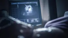 సోనోగ్రఫీ ఫోటో 