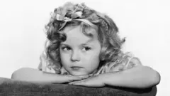 Shirley Temple olhandosport facil apostaladosport facil apostafotosport facil apostapreto e branco enquanto apoia seu queixo sobre as mãos