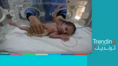 ولادة رضيعة من رحم أمها المتوفية في غزة