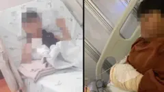 Crianças deitadas em camas de hospital com braços machucados