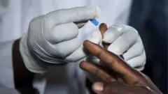 Yadda ake daukar samfurin jinin mutum ayi masa gwaji