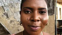A woman with scars on her face