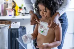 Deysi Vargas cuida da administração de alimentos por sonda para sua filha Sofia (nome fictício)